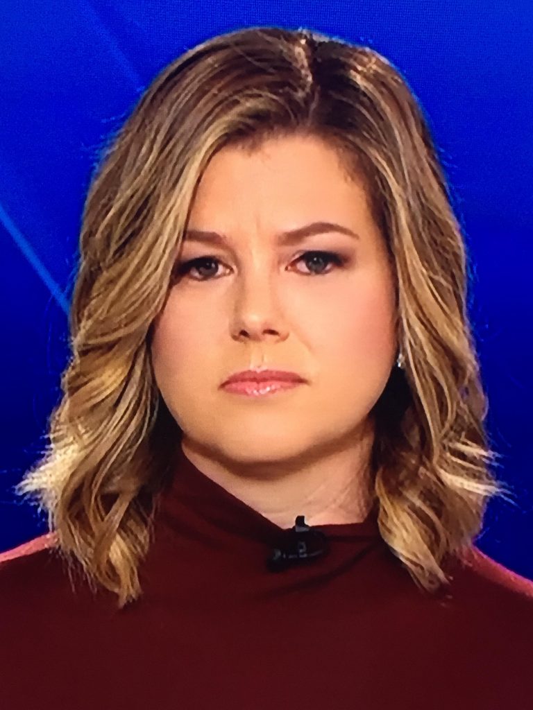 Brianna Keilar facelift