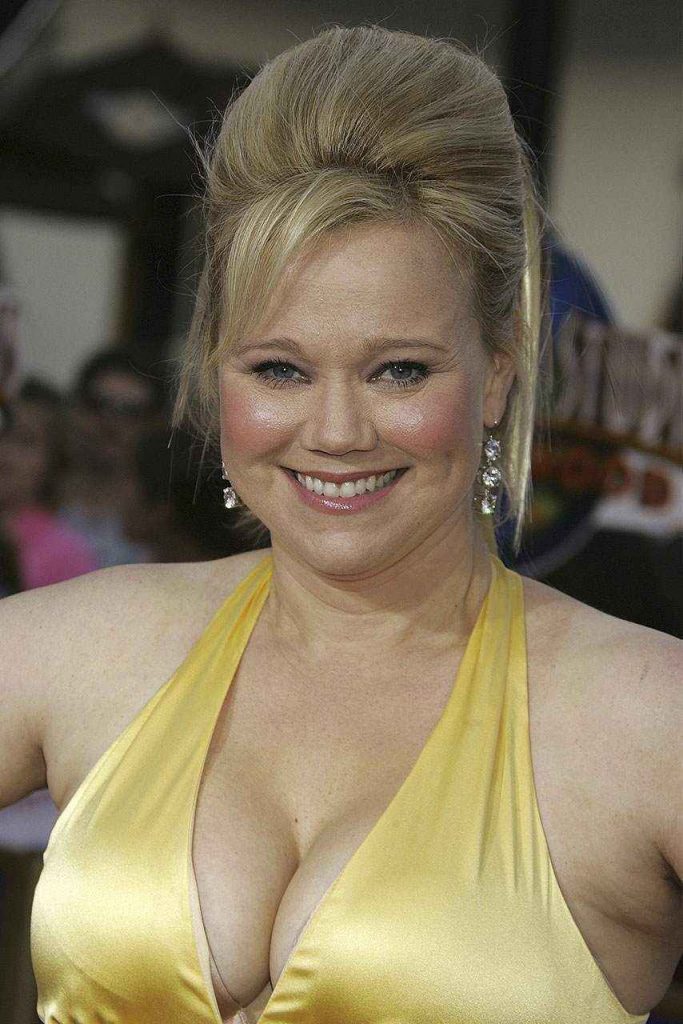 Caroline Rhea plastic surgery