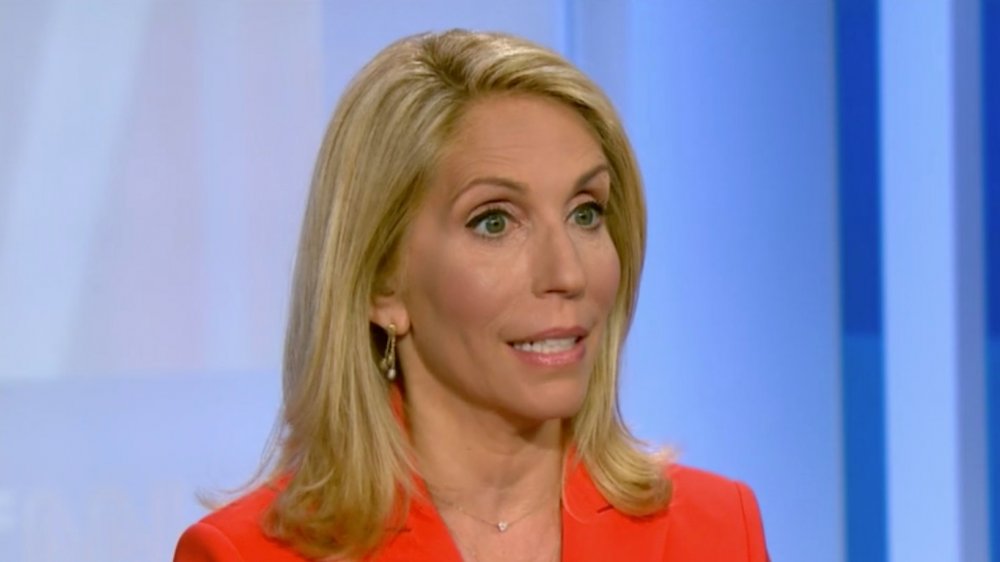 Dana Bash lip fillers