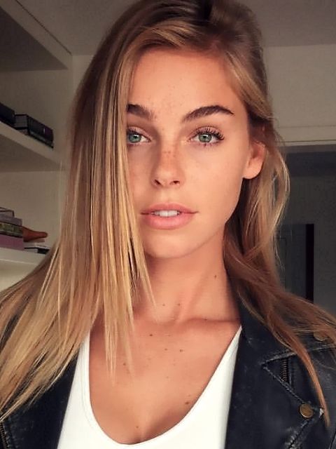 Elizabeth Turner botox