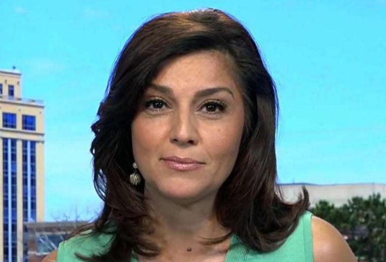 Rachel Campos-Duffy nose job boob job botox