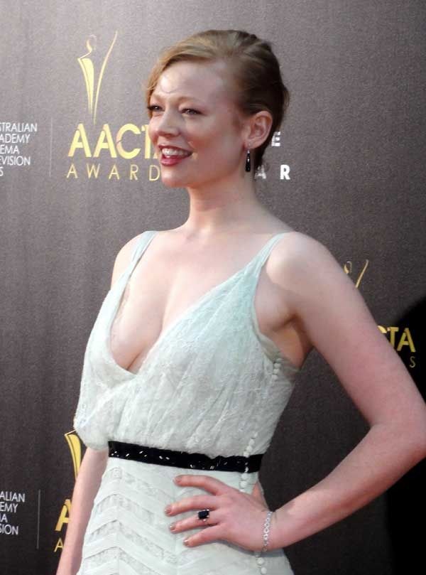 Sarah Snook plastic surgery procedures