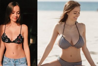 Sophie Mudd boob job nose job facelift