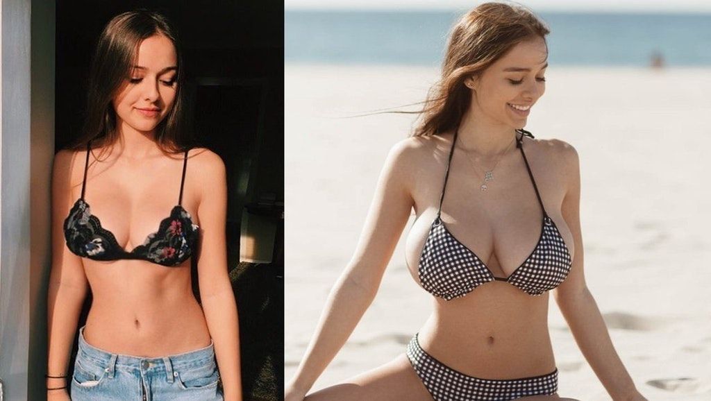 Sophie Mudd boob job nose job facelift