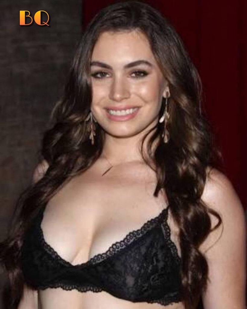 Sophie Simmons lip fillers