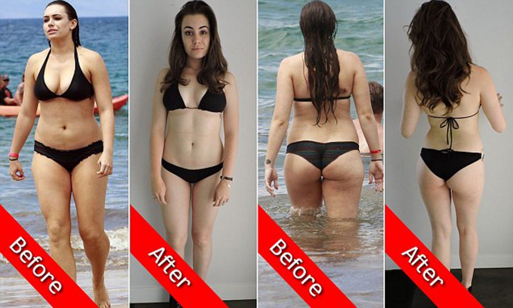 Sophie Simmons plastic surgery procedures