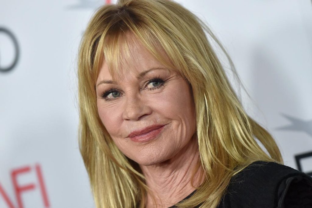 Melanie Griffith Cosmetic Surgery Face