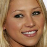 Anna Kournikova Plastic Surgery Procedures