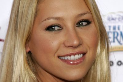 Anna Kournikova Plastic Surgery Procedures