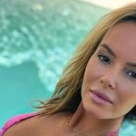 Amanda Holden Cosmetic Surgery