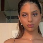 Suhana Khan Plastic Surgery Procedures