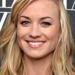 Yvonne Strahovski Cosmetic Surgery