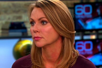 Lara Logan Cosmetic Surgery