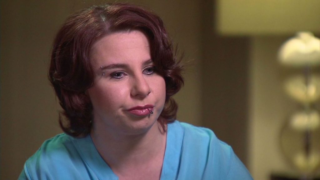 Michelle Knight Cosmetic Surgery Face