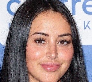 Marnie Simpson Plastic Surgery Procedures